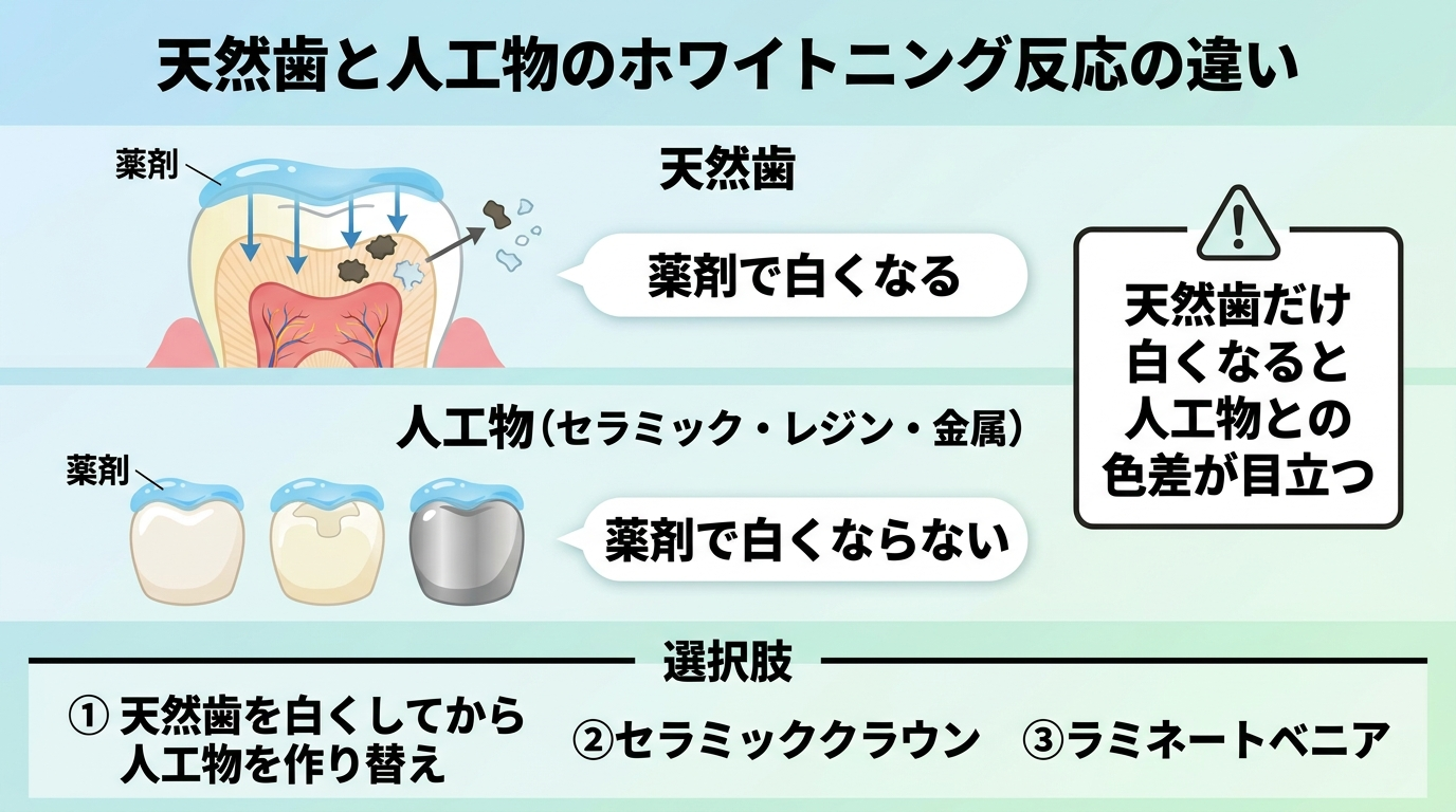 天然歯と人工物のホワイトニング反応の違いを示すインフォグラフィック。上段『天然歯』: 薬剤が内部に浸透し着色成分を分解して白くなるイラスト、ラベル『薬剤で白くなる』。下段『人工物(セラミック・レジン・金属)』: 薬剤をかけても色が変わらないイラスト、ラベル『薬剤で白くならない』。右側に『天然歯だけ白くなると人工物との色差が目立つ』と注記。下部に選択肢『①天然歯を白くしてから人工物を作り替え ②セラミッククラウン ③ラミネートベニア』