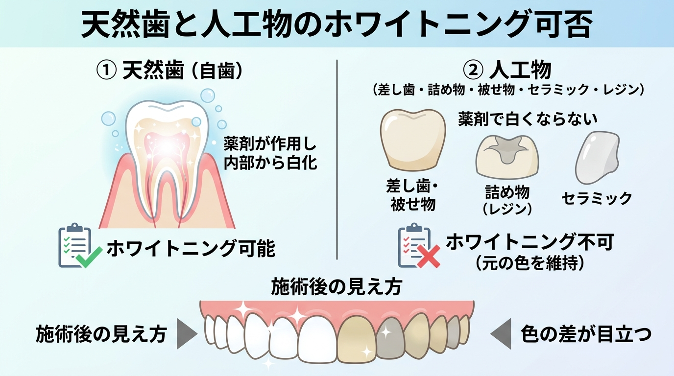 天然歯と人工物のホワイトニング可否を対比した図解イラスト。天然歯（薬剤が作用し内部から白くなる）と人工物（差し歯・詰め物・被せ物・セラミック・レジンは薬剤で白くならない）を並べ、施術後に色の差が目立つ様子を歯列イラストで示す
