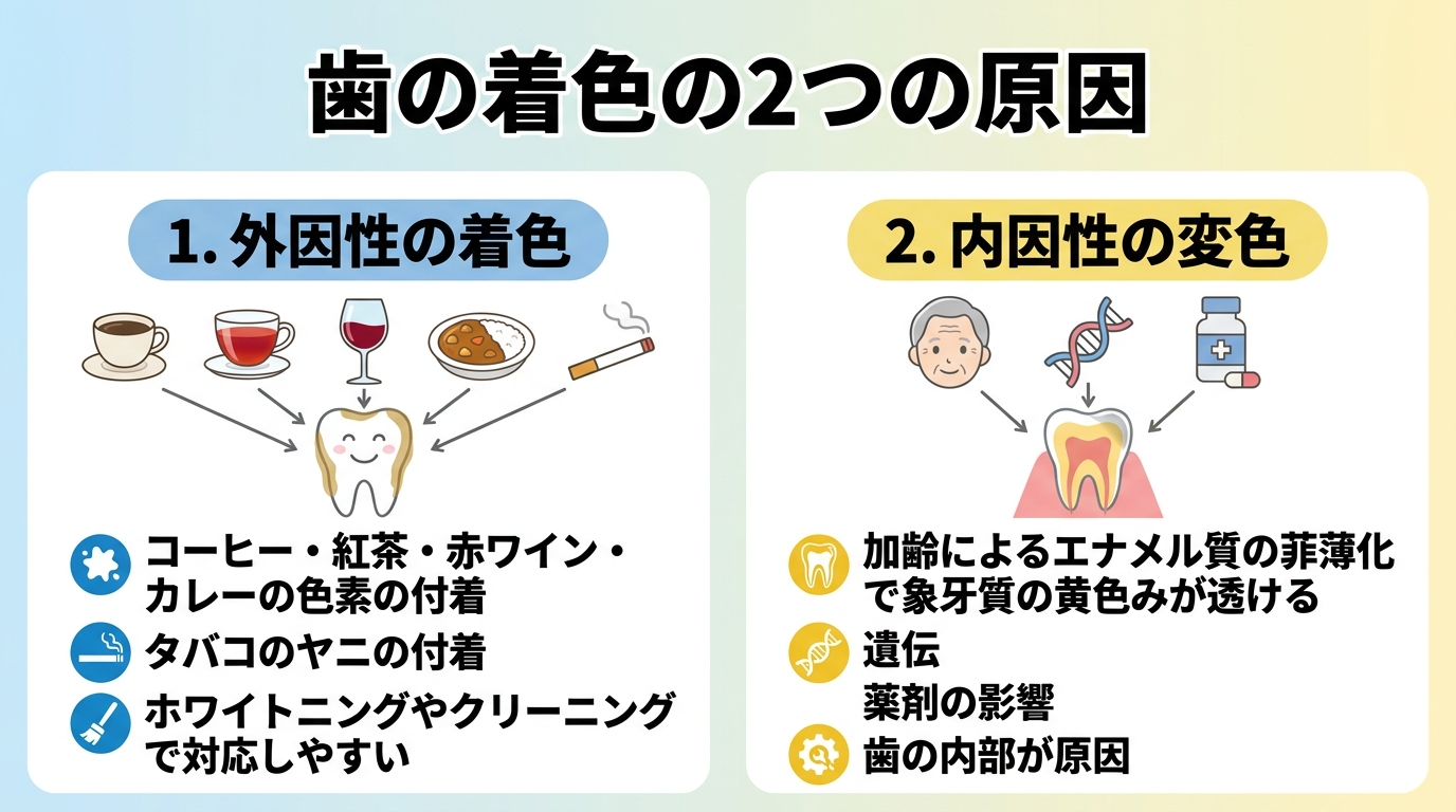 歯の着色の2つの原因を対比するイラスト。外因性の着色=コーヒー・紅茶・赤ワイン・カレーの色素やタバコのヤニが歯の表面に付着（ホワイトニングやクリーニングで対応しやすい）、内因性の変色=加齢によるエナメル質の菲薄化で象牙質の黄色みが透ける・遺伝・薬剤の影響（歯の内部が原因）、の2種類を並べた図解