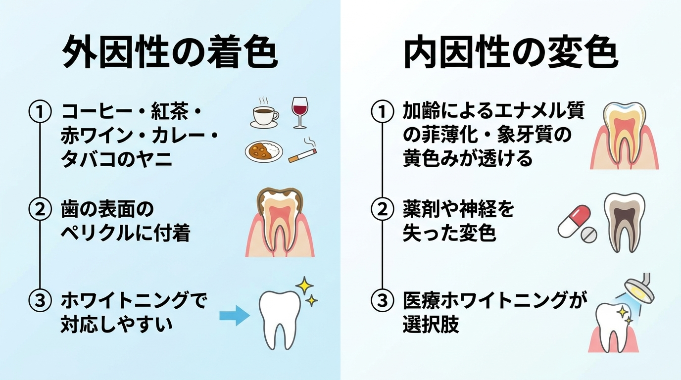 歯の変色の2タイプを比較したイラスト。外因性の着色=コーヒー・紅茶・赤ワイン・カレー・タバコのヤニが歯の表面のペリクルに付着・ホワイトニングで対応しやすい、内因性の変色=加齢によるエナメル質の菲薄化・象牙質の黄色みが透ける・薬剤や神経を失った変色・医療ホワイトニングが選択肢、の2つを左右に並べた図解