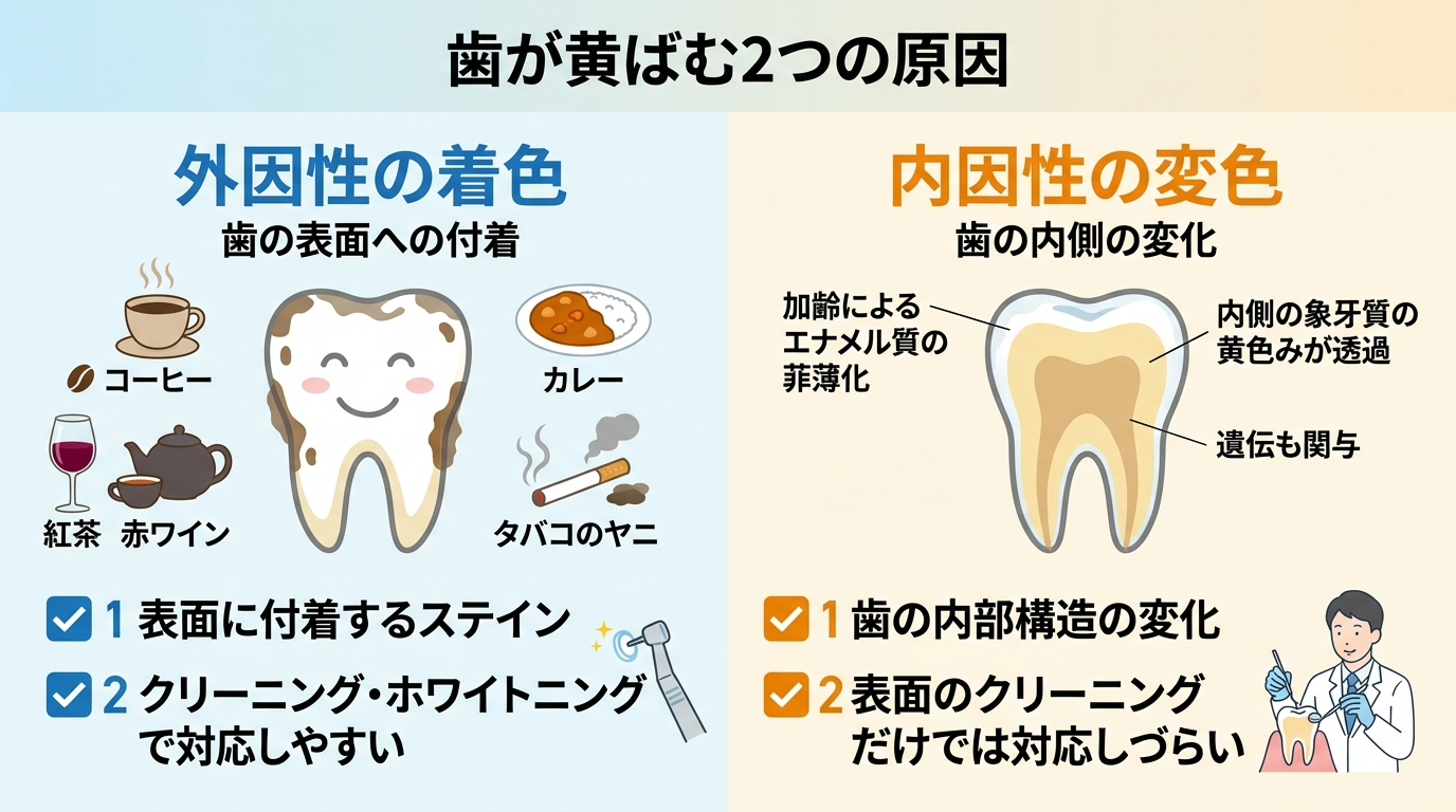 歯が黄ばむ2つの原因を比較したイラスト図。左側「外因性の着色」:コーヒー・紅茶・赤ワイン・カレー・タバコのヤニが歯の表面に付着するイメージ、クリーニング・ホワイトニングで対応しやすい。右側「内因性の変色」:加齢でエナメル質が薄くなり内側の象牙質の黄色みが透ける、遺伝も関与、表面のクリーニングだけでは対応しづらい