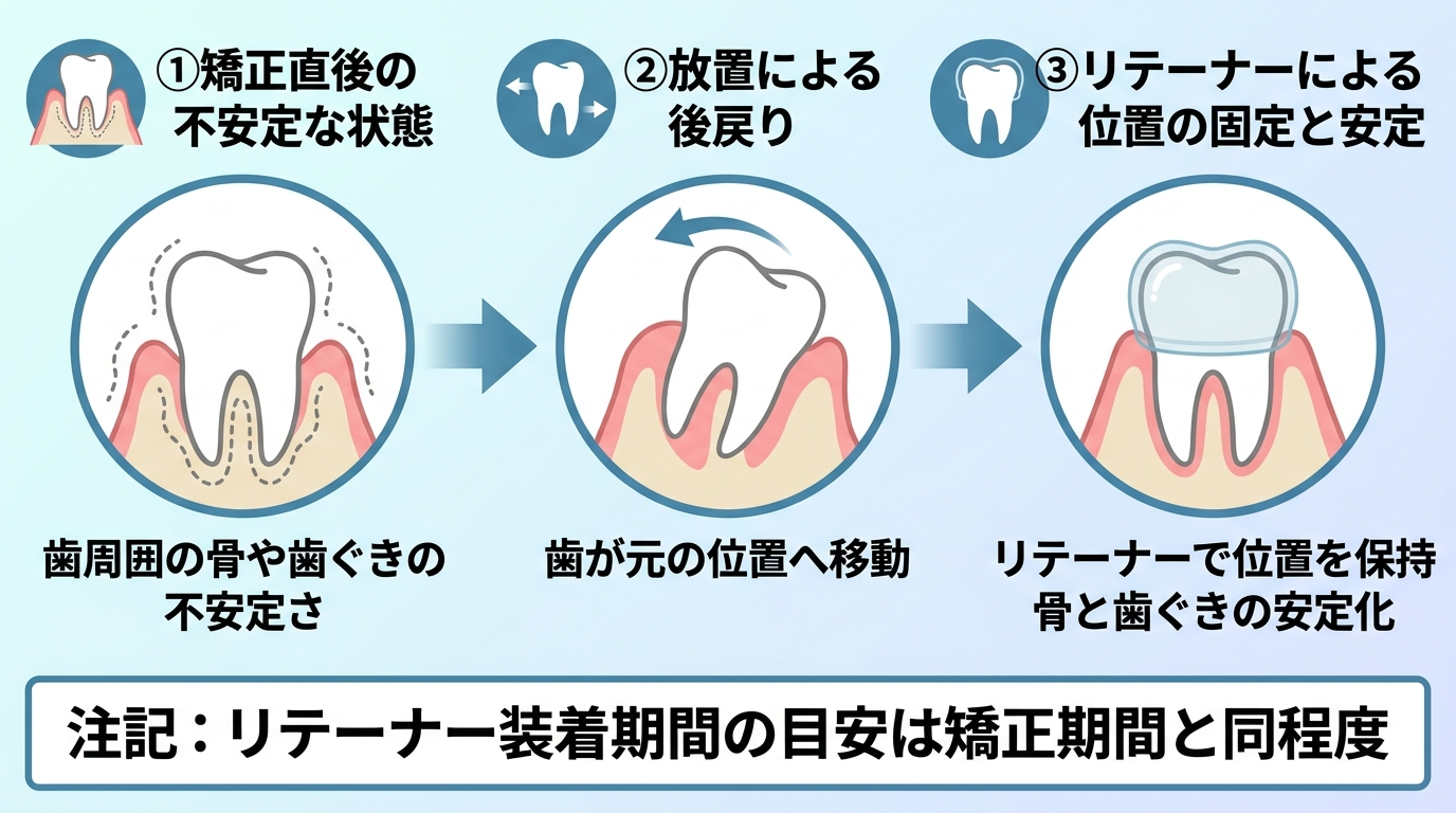 矯正後の後戻りと保定の仕組みを説明するイラスト。①矯正直後は歯の周囲の骨や歯ぐきが不安定 → ②放置すると歯が元の位置へ戻ろうとする(後戻り) → ③リテーナー(保定装置)で位置を固定し安定させる、の3ステップフロー。リテーナー装着期間は矯正期間と同程度が目安と注記