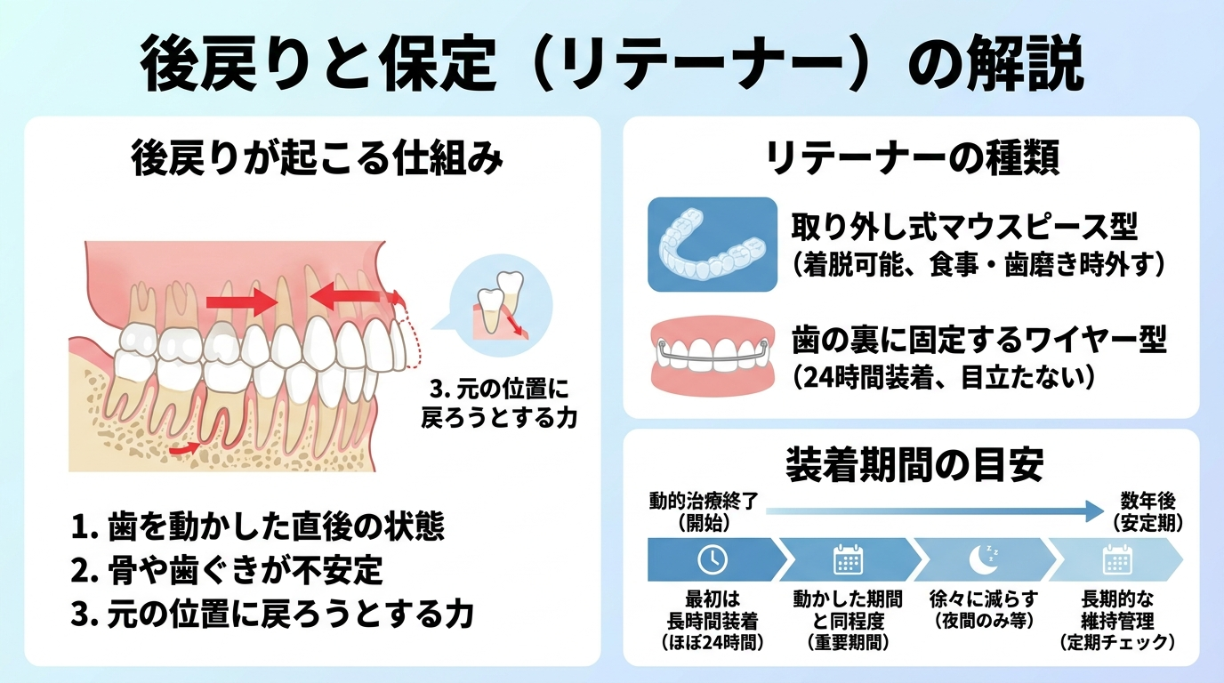 後戻りと保定(リテーナー)の解説イラスト。左に「後戻りが起こる仕組み」(歯を動かした直後は骨や歯ぐきが安定しておらず元の位置に戻ろうとする力が働く)、右に「リテーナーの種類」(取り外し式マウスピース型/歯の裏に固定するワイヤー型)。下部に装着期間の目安(動かした期間と同程度、最初は長時間→徐々に減らす)を時系列で表示