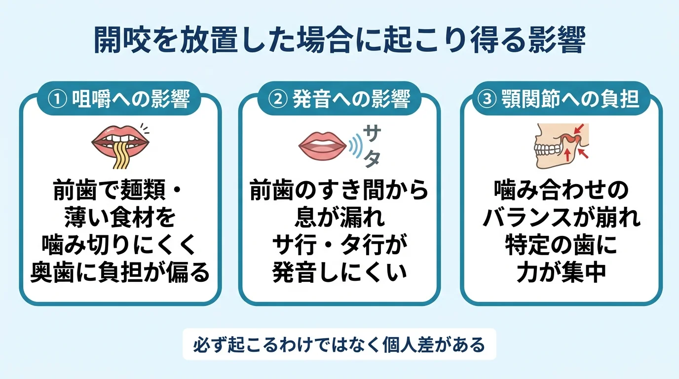 開咬を放置した場合に起こり得る影響インフォグラフィック。3項目を横並び:①咀嚼への影響(前歯で麺類・薄い食材を噛み切りにくく奥歯に負担が偏る)②発音への影響(前歯のすき間から息が漏れサ行・タ行が発音しにくい)③顎関節への負担(噛み合わせのバランスが崩れ特定の歯に力が集中)。下部に『必ず起こるわけではなく個人差がある』の注記