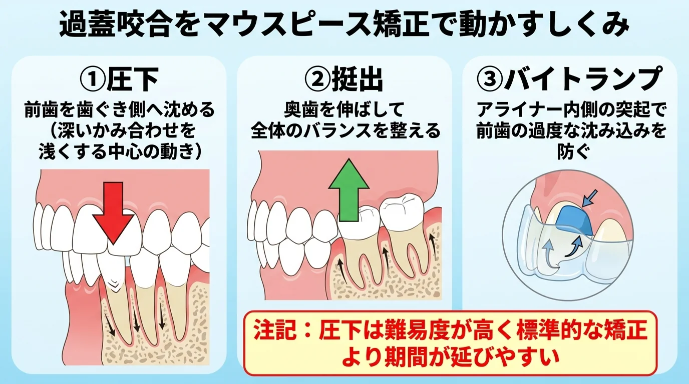 過蓋咬合をマウスピース矯正で動かすしくみの図解。①圧下=前歯を歯ぐき側へ沈める(深いかみ合わせを浅くする中心の動き)、②挺出=奥歯を伸ばして全体のバランスを整える、③バイトランプ=アライナー内側の突起で前歯の過度な沈み込みを防ぐ、の3つを矢印付きイラストで示す。注記『圧下は難易度が高く標準的な矯正より期間が延びやすい』