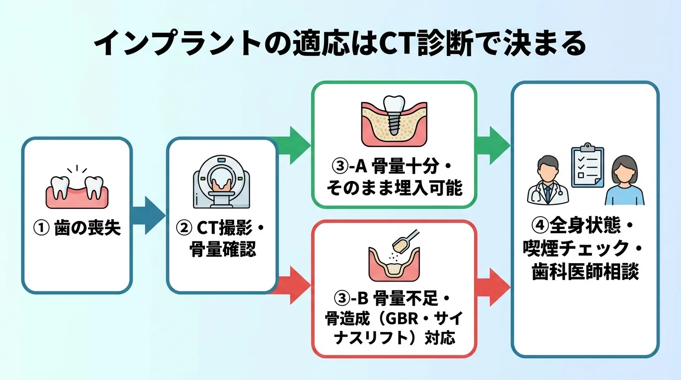 インプラント治療の適応判断フローを示すイラスト図。『歯を失った』→『CT撮影で骨量を確認』→分岐『骨量が十分→そのまま埋入可』『骨量が不足→骨造成（GBR・サイナスリフト）で対応』、さらに『全身状態・喫煙をチェック→歯科医師に相談』の流れ。タイトル『インプラントの適応はCT診断で決まる』