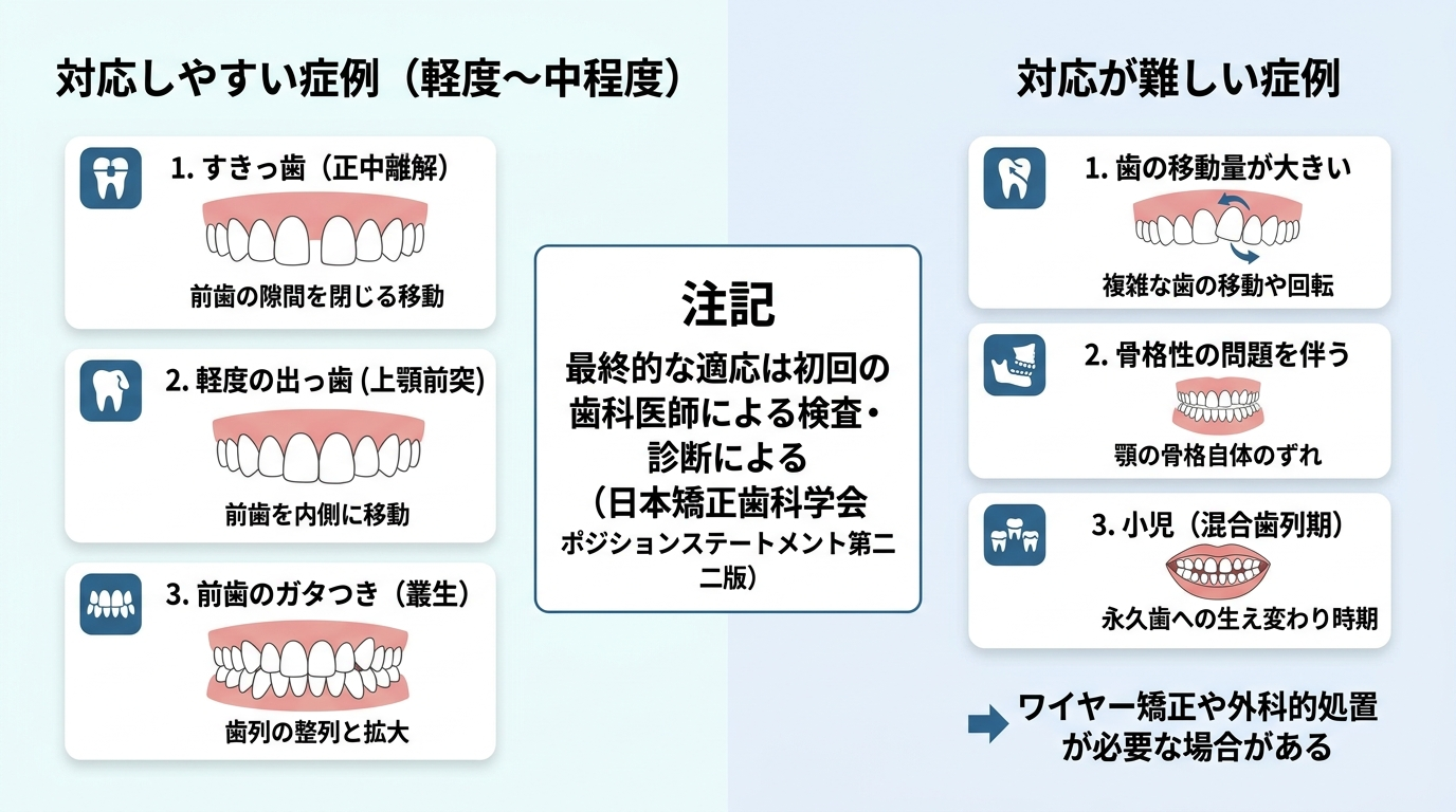 マウスピース矯正の適応・適応外を示すイラスト図。左側『対応しやすい症例(軽度〜中程度):すきっ歯・軽度の出っ歯・前歯のガタつき』を歯並びイラストで、右側『対応が難しい症例:歯の移動量が大きい・骨格性の問題を伴う・小児 → ワイヤー矯正や外科的処置が必要な場合がある』を対比。中央に注記『最終的な適応は初回の歯科医師による検査・診断による(日本矯正歯科学会 ポジションステートメント第二版)』