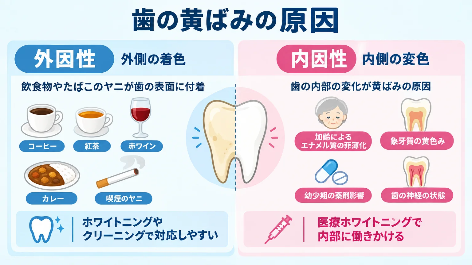 歯の黄ばみの原因を外因性と内因性の2タイプに分けて図解するイラスト。左側=外因性(外側の着色): コーヒー・紅茶・赤ワイン・カレー・喫煙のヤニが歯の表面に付着、ホワイトニングやクリーニングで対応しやすい。右側=内因性(内側の変色): 加齢によるエナメル質の菲薄化・象牙質の黄色み・幼少期の薬剤影響・歯の神経の状態、医療ホワイトニングで内部に働きかける