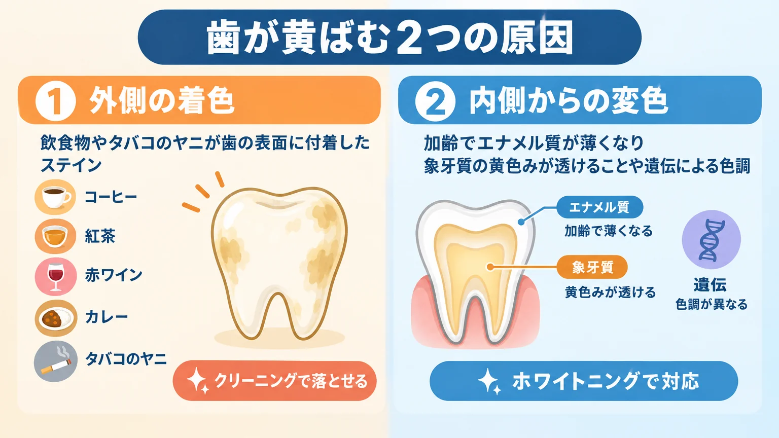 歯が黄ばむ2つの原因を対比したイラスト。左側:外側の着色(コーヒー・紅茶・赤ワイン・カレー・タバコのヤニが歯の表面に付着したステイン、クリーニングで落とせる)。右側:内側からの変色(加齢でエナメル質が薄くなり象牙質の黄色みが透ける、遺伝による色調、ホワイトニングで対応)