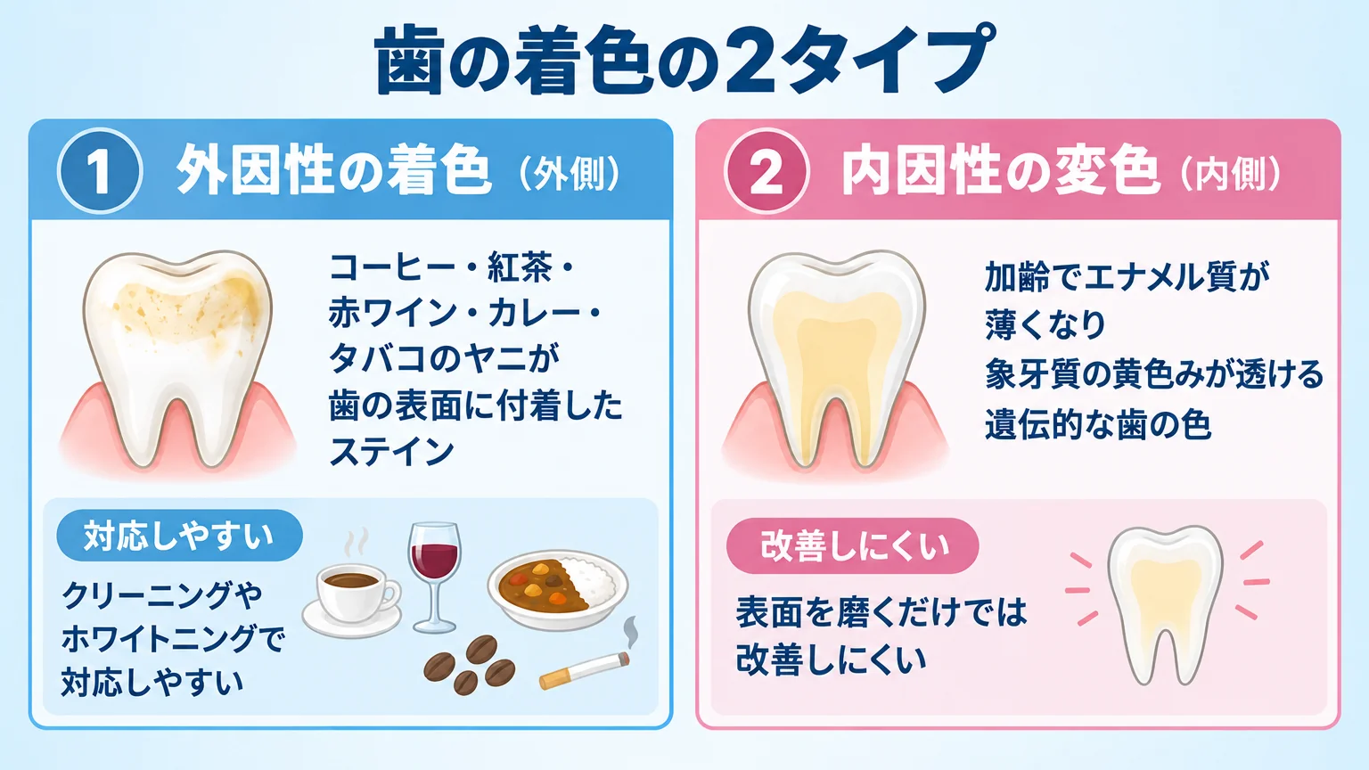 歯の着色の2タイプを比較した図解。外因性の着色(外側):コーヒー・紅茶・赤ワイン・カレー・タバコのヤニが歯の表面に付着したステイン、クリーニングやホワイトニングで対応しやすい。内因性の変色(内側):加齢でエナメル質が薄くなり象牙質の黄色みが透ける、遺伝的な歯の色、表面を磨くだけでは改善しにくい