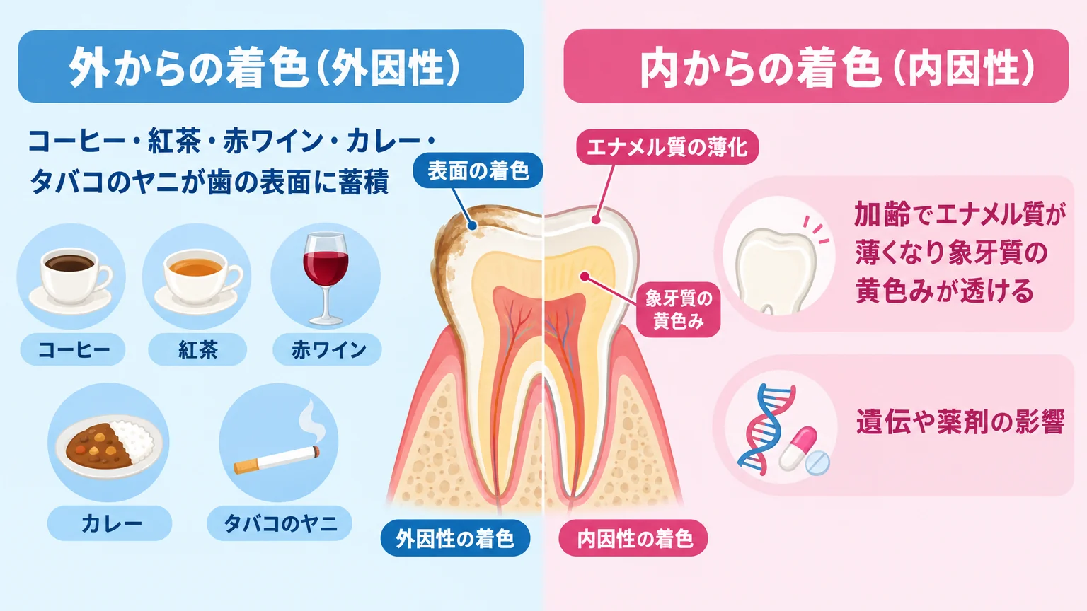 歯の着色の原因を外因性と内因性に分けて説明する図解イラスト。左側『外からの着色（外因性）：コーヒー・紅茶・赤ワイン・カレー・タバコのヤニが歯の表面に蓄積』、右側『内からの着色（内因性）：加齢でエナメル質が薄くなり象牙質の黄色みが透ける・遺伝や薬剤の影響』を歯の断面図とともに対比表示