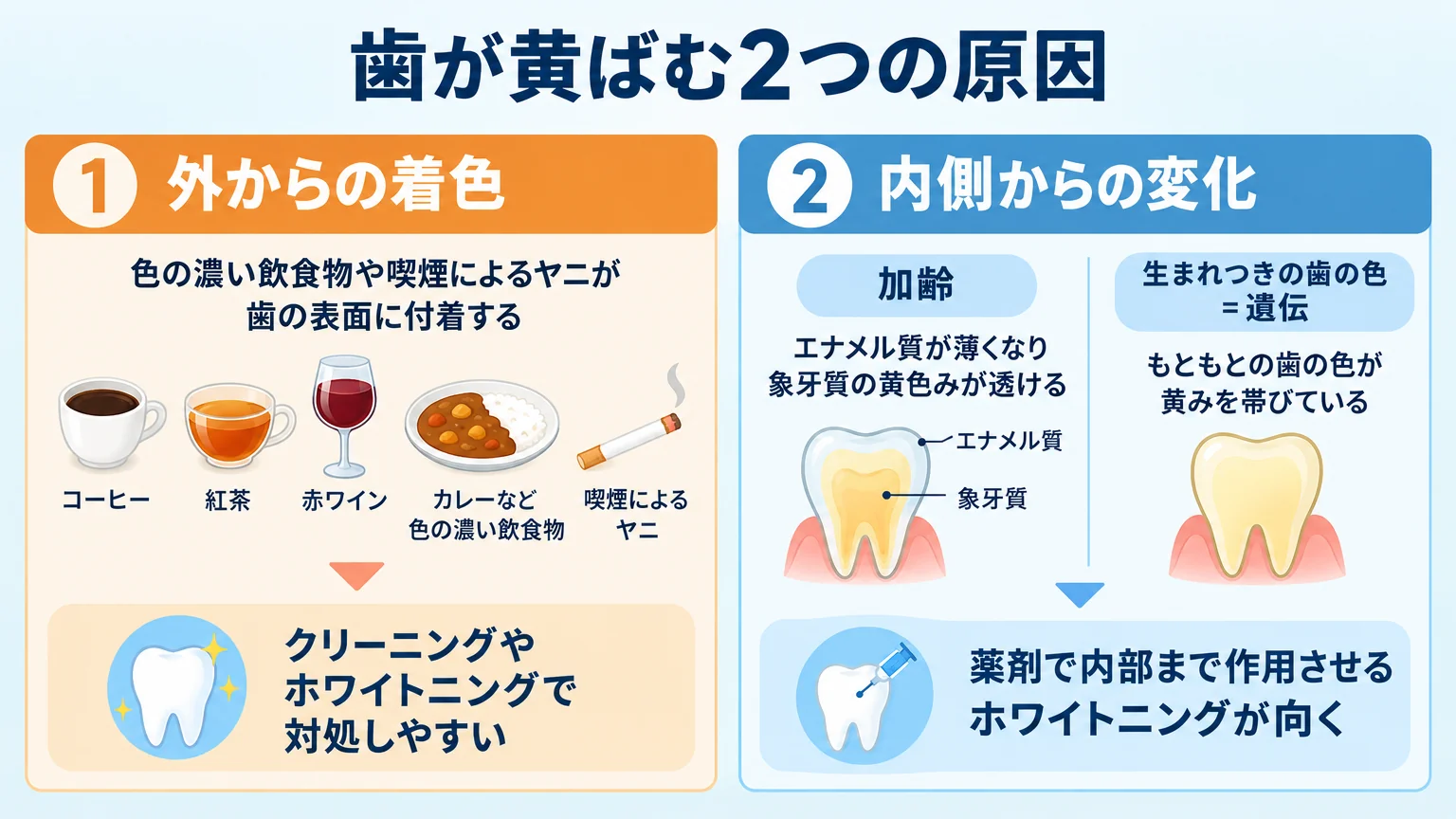 歯が黄ばむ2つの原因を対比するインフォグラフィック。左:外からの着色(コーヒー・紅茶・赤ワイン・カレーなど色の濃い飲食物、喫煙によるヤニ→クリーニングやホワイトニングで対処しやすい)、右:内側からの変化(加齢でエナメル質が薄くなり象牙質の黄色みが透ける、生まれつきの歯の色=遺伝→薬剤で内部まで作用させるホワイトニングが向く)