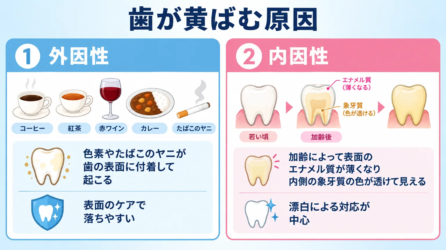 歯が黄ばむ原因を外因性と内因性に分けて解説した図解。外因性:コーヒー・紅茶・赤ワイン・カレーなどの色素やたばこのヤニが歯の表面に付着して起こる・表面のケアで落ちやすい。内因性:加齢によって表面のエナメル質が薄くなり内側の象牙質の色が透けて見える・漂白による対応が中心。の2種類を対比したイラスト