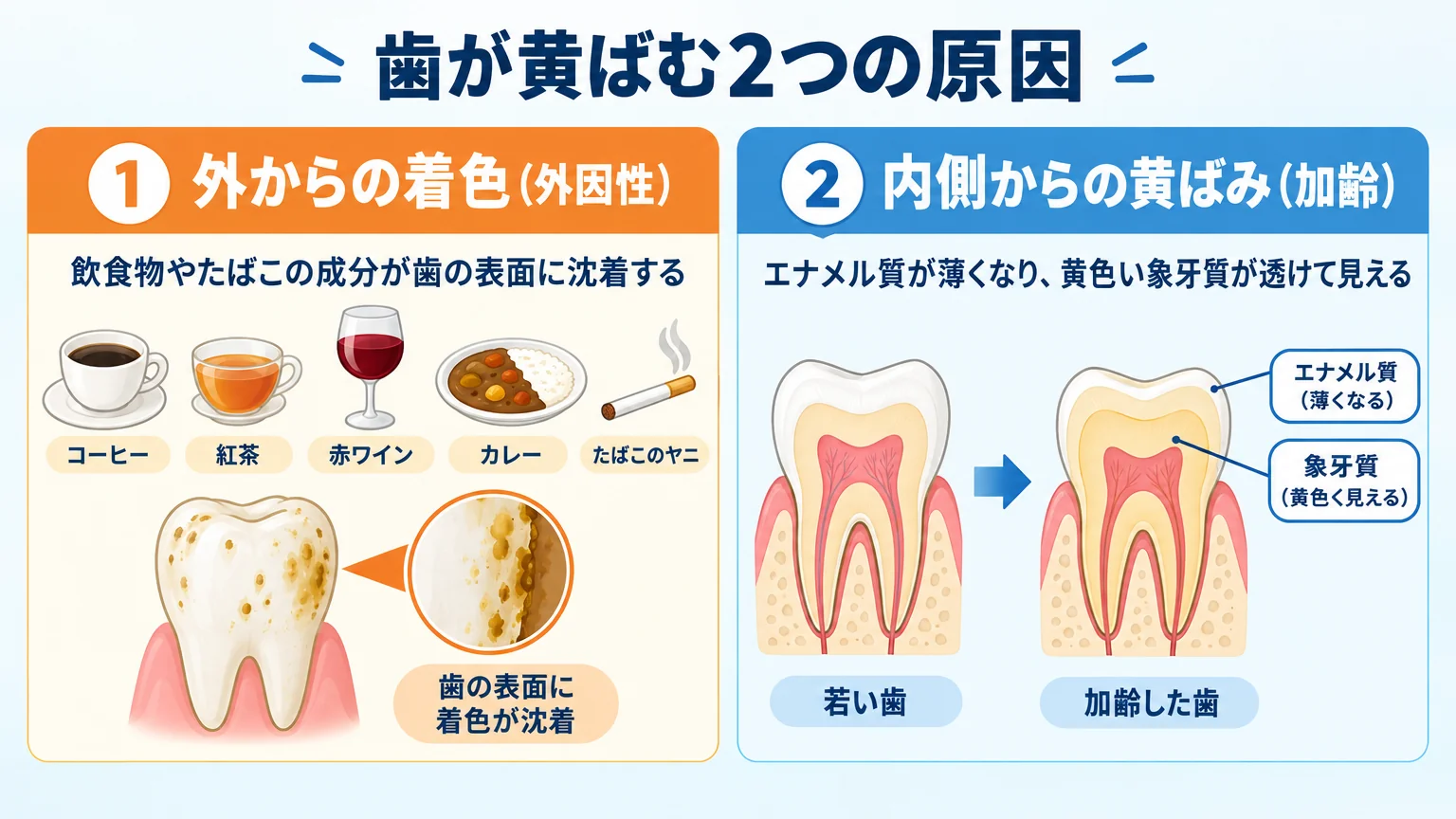 歯が黄ばむ2つの原因を図解するイラスト。左に『外からの着色（外因性）』としてコーヒー・紅茶・赤ワイン・カレー・たばこのヤニが歯の表面に沈着する様子、右に『内側からの黄ばみ（加齢）』としてエナメル質が薄くなり黄色い象牙質が透けて見える歯の断面を並べる