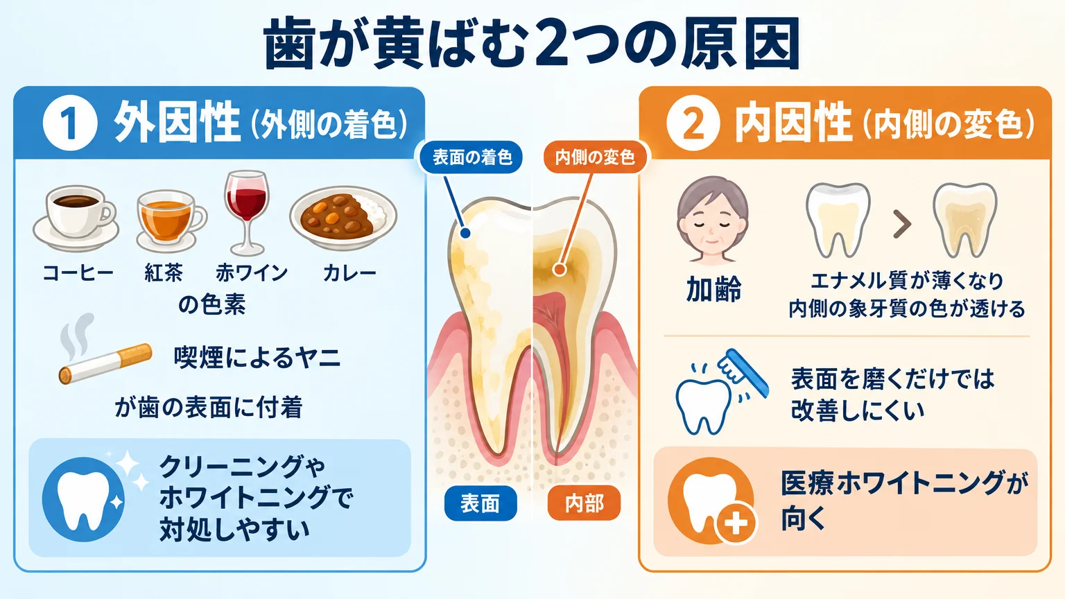 歯が黄ばむ2つの原因を図解するイラスト。左に「外因性（外側の着色）」:コーヒー・紅茶・赤ワイン・カレーの色素、喫煙によるヤニが歯の表面に付着、クリーニングやホワイトニングで対処しやすい。右に「内因性（内側の変色）」:加齢でエナメル質が薄くなり内側の象牙質の色が透ける、表面を磨くだけでは改善しにくく医療ホワイトニングが向く。歯の断面図で表面と内部の違いを表現