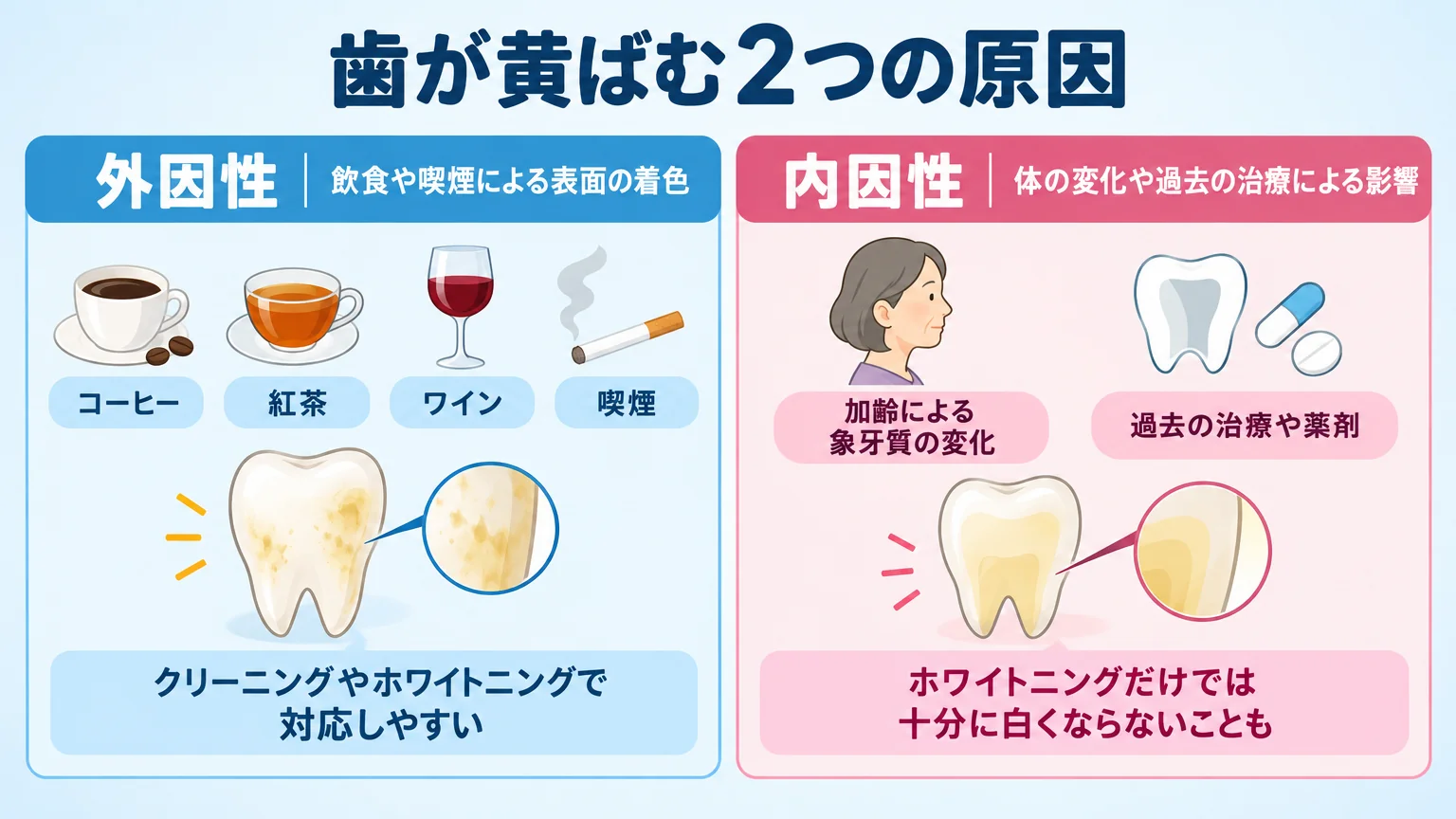 歯が黄ばむ原因を外因性と内因性で分けて解説するイラスト図。外因性:コーヒー・紅茶・ワイン・喫煙による表面の着色（クリーニングやホワイトニングで対応しやすい）、内因性:加齢による象牙質の変化・過去の治療や薬剤（ホワイトニングだけでは十分に白くならないことも）。2つの原因を左右に分けて図解。タイトル『歯が黄ばむ2つの原因』