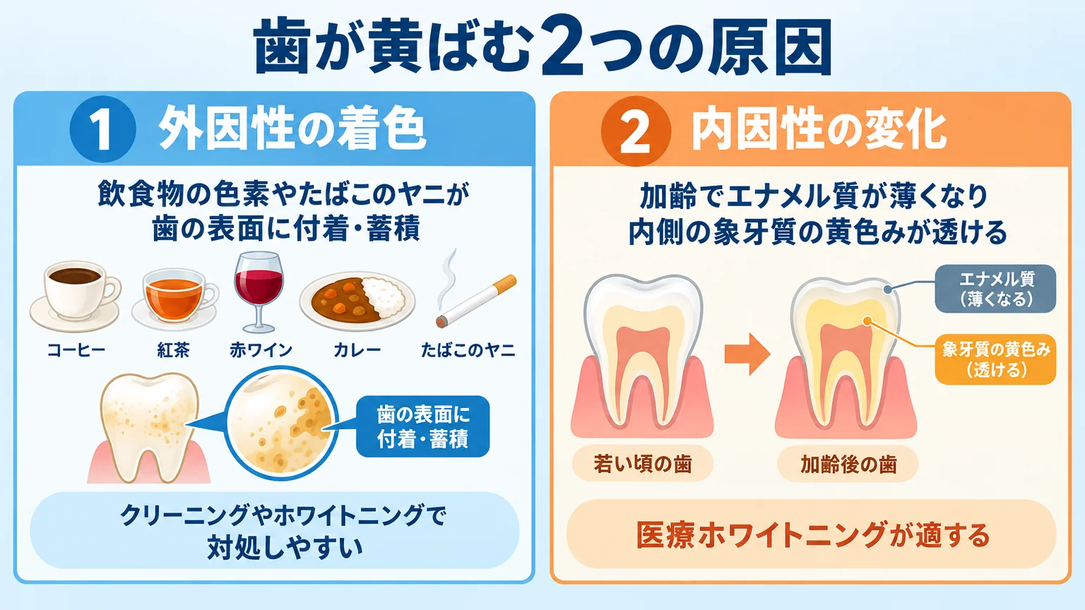 歯が黄ばむ2つの原因を対比するイラスト。左=外因性の着色(コーヒー・紅茶・赤ワイン・カレーの色素、たばこのヤニが歯の表面に付着・蓄積。クリーニングやホワイトニングで対処しやすい)、右=内因性の変化(加齢でエナメル質が薄くなり内側の象牙質の黄色みが透ける。医療ホワイトニングが適する)。タイトルは『歯が黄ばむ2つの原因』