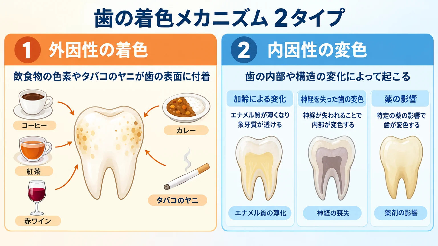歯の着色メカニズムを2タイプで示すイラスト図解。左側に外因性の着色(コーヒー・紅茶・赤ワイン・カレーの色素、タバコのヤニが歯の表面に付着するイメージ)、右側に内因性の変色(加齢でエナメル質が薄くなり象牙質が透ける、神経を失った歯の変色、薬の影響)を対比して描く