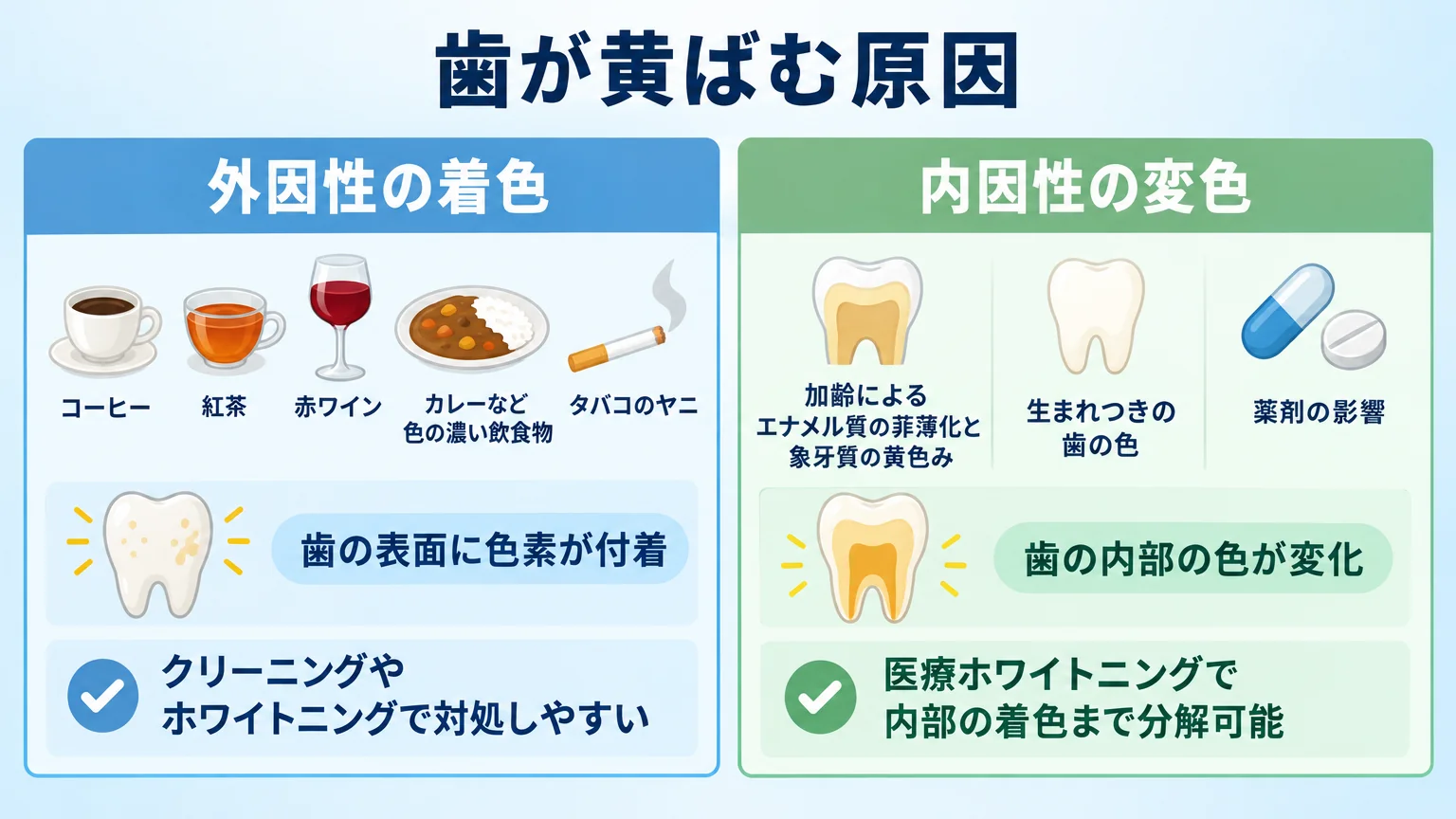 歯が黄ばむ原因を外因性と内因性に分けて説明するインフォグラフィック。左側『外因性の着色』: コーヒー・紅茶・赤ワイン・カレーなど色の濃い飲食物、タバコのヤニ。歯の表面に色素が付着、クリーニングやホワイトニングで対処しやすい。右側『内因性の変色』: 加齢によるエナメル質の菲薄化と象牙質の黄色み、生まれつきの歯の色、薬剤の影響。歯の内部の色が変化、医療ホワイトニングで内部の着色まで分解可能