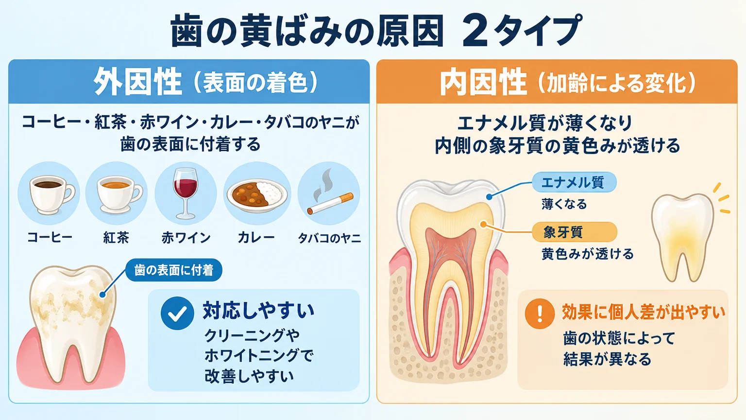 歯の黄ばみの原因を2タイプで対比するインフォグラフィック。左側「外因性(表面の着色)」=コーヒー・紅茶・赤ワイン・カレー・タバコのヤニが歯の表面に付着、クリーニングやホワイトニングで対応しやすい。右側「内因性(加齢による変化)」=エナメル質が薄くなり内側の象牙質の黄色みが透ける、効果に個人差が出やすい。歯の断面図付き