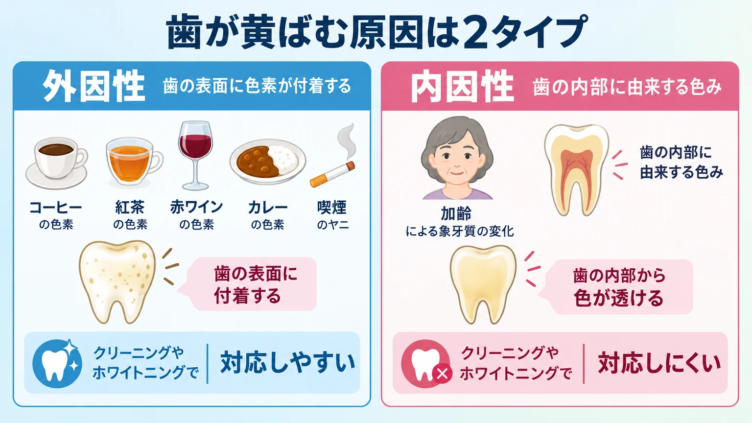 歯が黄ばむ原因を外因性と内因性の2タイプで解説するイラスト。外因性（コーヒー・紅茶・赤ワイン・カレーの色素、喫煙のヤニが歯の表面に付着）と内因性（加齢による象牙質の変化、歯の内部に由来する色み）を対比し、それぞれクリーニングやホワイトニングで対応しやすい/しにくいを示す
