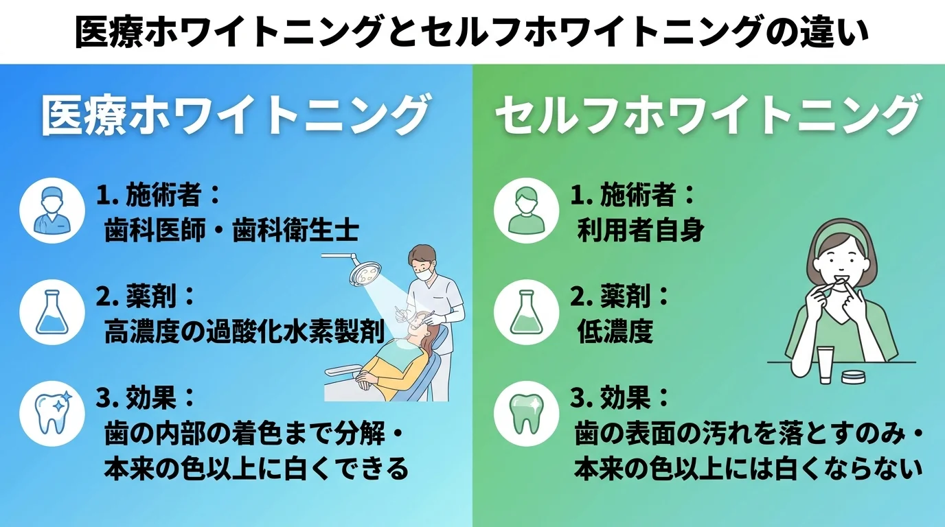 医療ホワイトニングとセルフホワイトニングの違いを比較するインフォグラフィック。左:医療ホワイトニング（施術者=歯科医師・歯科衛生士、薬剤=高濃度の過酸化水素製剤、効果=歯の内部の着色まで分解・本来の色以上に白くできる）、右:セルフホワイトニング（施術者=利用者自身、薬剤=低濃度、効果=歯の表面の汚れを落とすのみ・本来の色以上には白くならない）