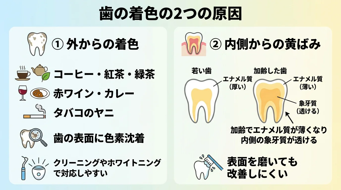 歯の着色の2つの原因を対比したイラスト。左側『外からの着色』=コーヒー・紅茶・緑茶・赤ワイン・カレー・タバコのヤニが歯の表面に色素沈着、クリーニングやホワイトニングで対応しやすい。右側『内側からの黄ばみ』=加齢でエナメル質が薄くなり内側の象牙質が透ける、表面を磨いても改善しにくい