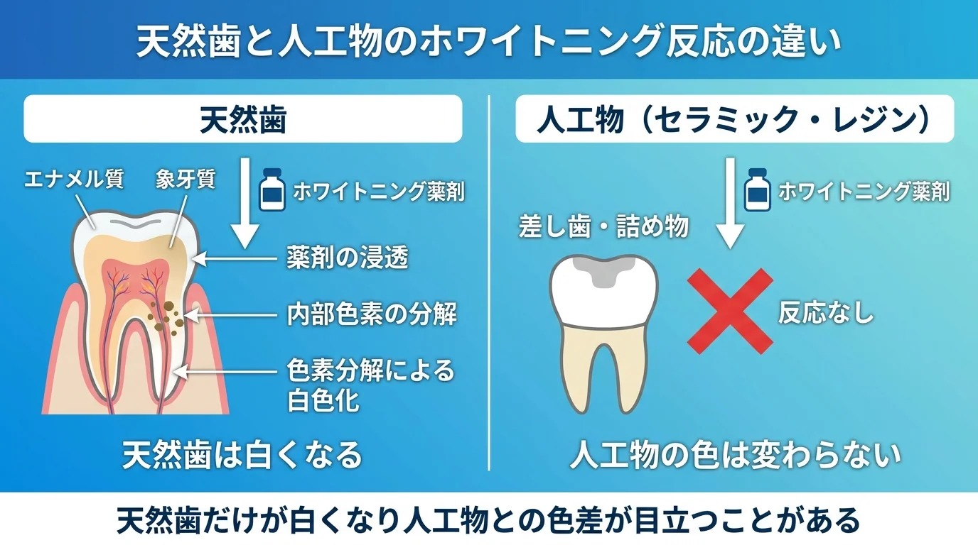 天然歯と人工物のホワイトニング反応の違いを示すイラスト。左に「天然歯」としてエナメル質と象牙質の断面を描き、薬剤が内部の色素を分解して白くなる様子を矢印で表現。右に「人工物（セラミック・レジン）」として差し歯・詰め物を描き、薬剤をかけても色が変わらない様子をバツ印で表現。下部に「天然歯だけが白くなり人工物との色差が目立つことがある」と注記