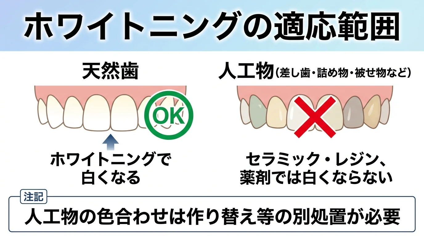 ホワイトニングで白くできる歯とできない歯を示すイラスト。天然歯（ホワイトニングで白くなる・OKマーク）と、差し歯・詰め物・被せ物などの人工物（セラミック・レジン、薬剤では白くならない・NGマーク）を口腔内図で対比。人工物の色を周囲に合わせるには作り替えなどの別処置が必要である旨を注記