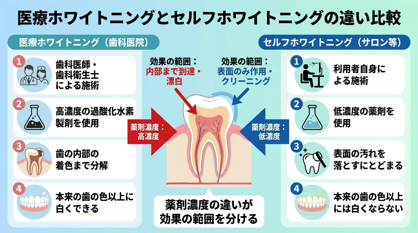 医療ホワイトニングとセルフホワイトニングの違いを比較するインフォグラフィック。医療ホワイトニング:高濃度の過酸化水素製剤、歯科医師・歯科衛生士が施術、歯の内部の着色まで分解し本来の歯の色以上に白くできる。セルフホワイトニング:低濃度の薬剤、利用者自身が施術、表面の汚れを落とすにとどまり本来の歯の色以上には白くならない。薬剤濃度の違いが効果の範囲を分けることを矢印で示す