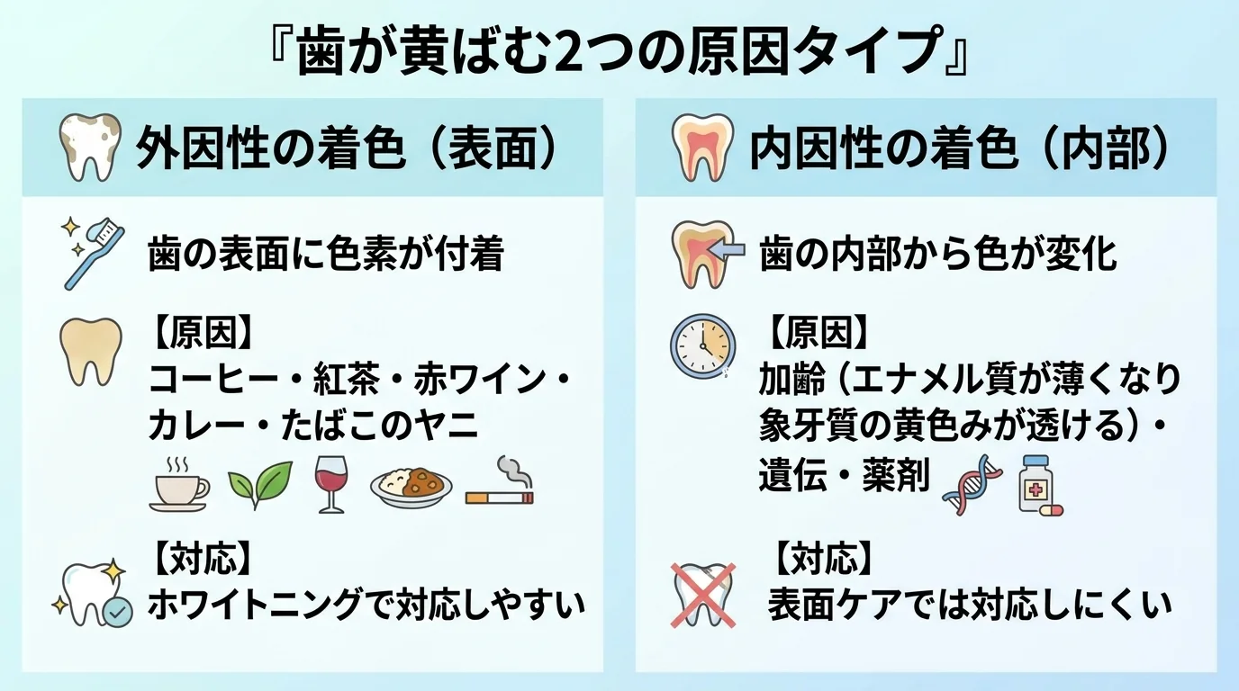 歯の黄ばみの原因を外因性・内因性の2タイプで対比したイラスト。外因性の着色:歯の表面に色素が付着、原因はコーヒー・紅茶・赤ワイン・カレー・たばこのヤニ、ホワイトニングで対応しやすい。内因性の着色:歯の内部から色が変化、原因は加齢(エナメル質が薄くなり象牙質の黄色みが透ける)・遺伝・薬剤、表面ケアでは対応しにくい。タイトルは『歯が黄ばむ2つの原因タイプ』