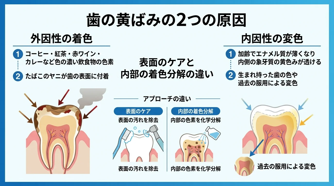 歯の黄ばみの2つの原因を図解。左側：外因性の着色（コーヒー・紅茶・赤ワイン・カレーなど色の濃い飲食物の色素、たばこのヤニが歯の表面に付着）。右側：内因性の変色（加齢でエナメル質が薄くなり内側の象牙質の黄色みが透ける、生まれ持った歯の色や過去の服薬による変色）。表面のケアと内部の着色分解の違いを示すイラスト