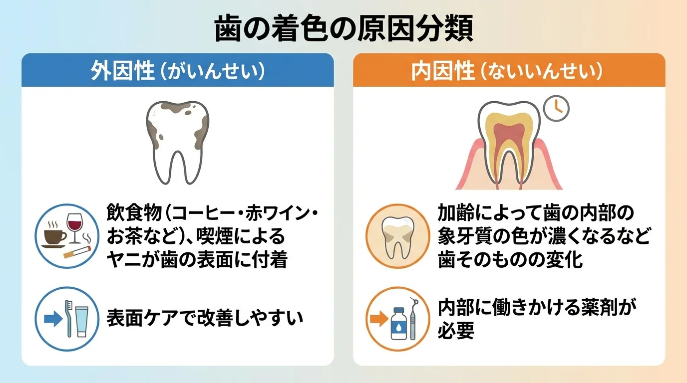 歯の着色の原因分類イラスト。外因性: コーヒー・赤ワイン・お茶などの飲食物、喫煙によるヤニが歯の表面に付着。内因性: 加齢によって歯の内部の象牙質の色が濃くなるなど歯そのものの変化。表面ケアで改善しやすいのは外因性、内部に働きかける薬剤が必要なのは内因性。