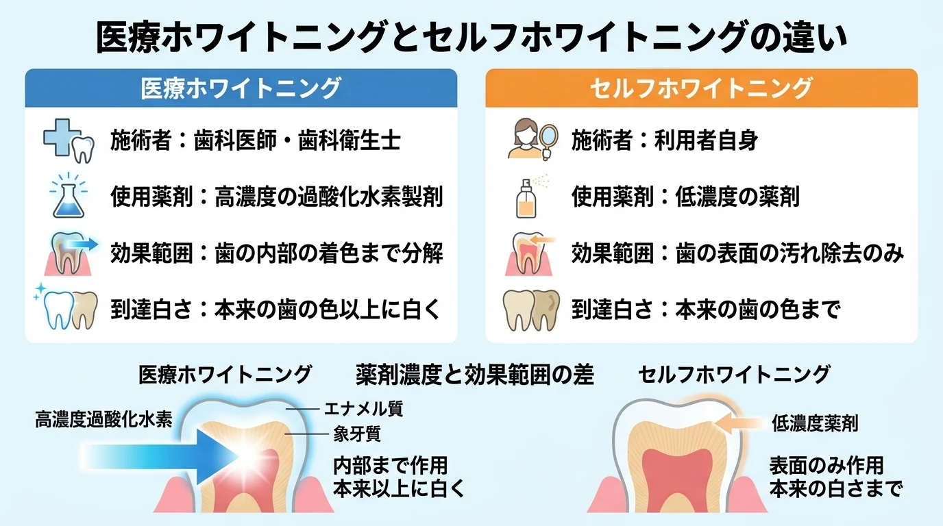 医療ホワイトニングとセルフホワイトニングの違いを比較するインフォグラフィック。医療ホワイトニング:歯科医師・歯科衛生士が施術、高濃度の過酸化水素製剤を使用、歯の内部の着色まで分解し本来の歯の色以上に白くできる。セルフホワイトニング:利用者自身が施術、低濃度の薬剤、歯の表面の汚れを落とすにとどまり本来の歯の色以上には白くならない。薬剤濃度と効果範囲の差を図示