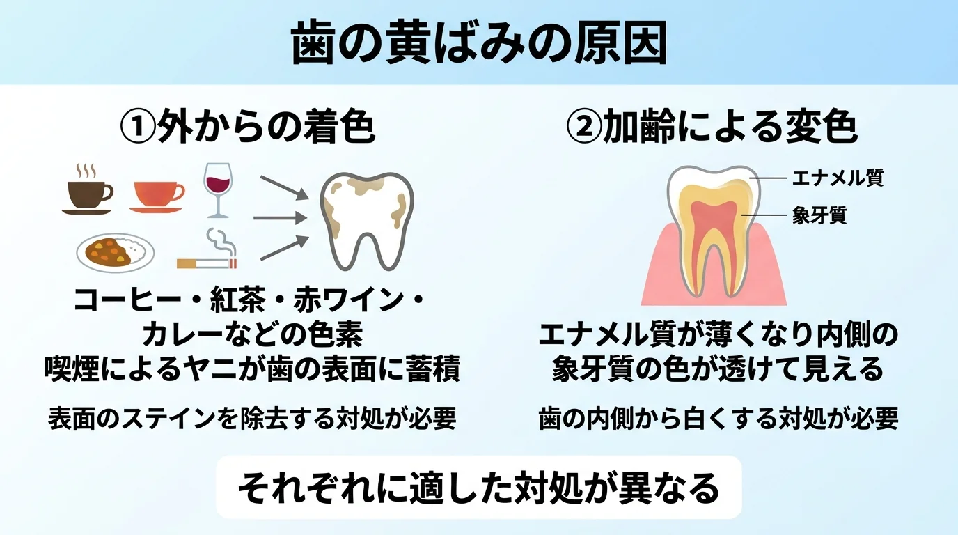 歯が黄ばむ原因を2タイプに分けて図解したイラスト。①外からの着色:コーヒー・紅茶・赤ワイン・カレーなどの色素、喫煙によるヤニが歯の表面に蓄積。②加齢による変色:エナメル質が薄くなり内側の象牙質の色が透けて見える。それぞれに適した対処が異なることを示す