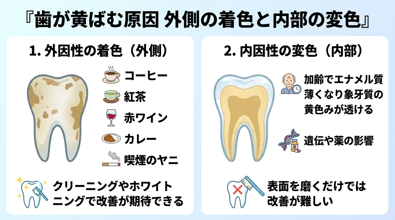 歯が黄ばむ2つの原因を対比するイラスト図。左側『外因性の着色（外側）』：コーヒー・紅茶・赤ワイン・カレー・喫煙のヤニが歯の表面に沈着、クリーニングやホワイトニングで改善が期待できる。右側『内因性の変色（内部）』：加齢でエナメル質が薄くなり象牙質の黄色みが透ける、遺伝や薬の影響、表面を磨くだけでは改善が難しい。タイトル『歯が黄ばむ原因 外側の着色と内部の変色』
