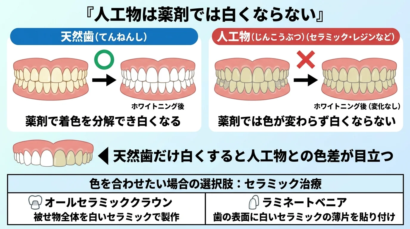 天然歯と人工物のホワイトニング可否を示した説明イラスト。天然歯：薬剤で着色を分解でき白くなる（○）。セラミック・レジンなど人工物：薬剤では色が変わらず白くならない（×）。天然歯だけ白くすると人工物との色差が目立つことを図示。色を合わせたい場合はセラミック治療（オールセラミッククラウン・ラミネートベニア）の選択肢を併記。タイトルは『人工物は薬剤では白くならない』