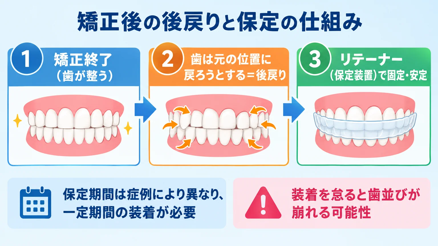 矯正後の後戻りと保定の仕組みを示すフロー図。『矯正終了（歯が整う）』→『歯は元の位置に戻ろうとする＝後戻り』→『リテーナー（保定装置）で固定・安定』の3ステップを矢印でつなぐ。下部に『保定期間は症例により異なり、一定期間の装着が必要』『装着を怠ると歯並びが崩れる可能性』と注記