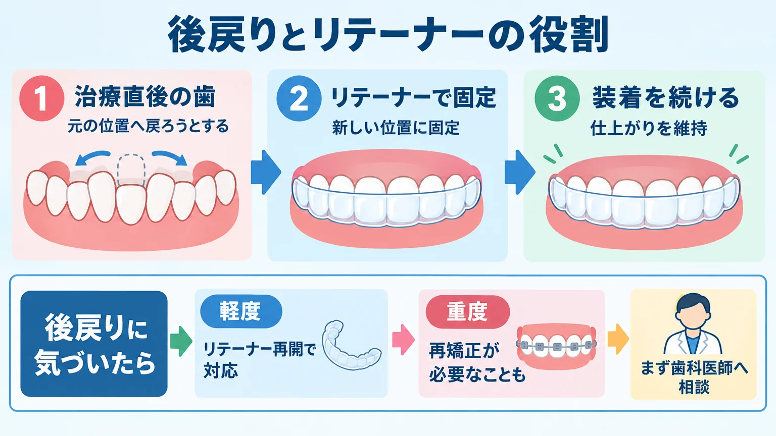 後戻りとリテーナーの役割を示すイラスト。治療直後の歯は元の位置へ戻ろうとする→リテーナー（保定装置）で新しい位置に固定→装着を続けて仕上がりを維持。下部に『後戻りに気づいたら』フロー=軽度はリテーナー再開で対応／重度は再矯正が必要なことも→まず歯科医師へ相談。