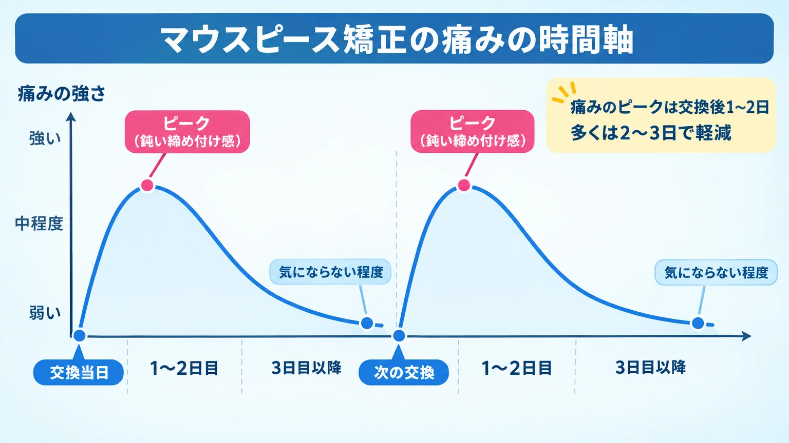 マウスピース矯正の痛みの時間軸グラフ。横軸が「交換当日→1〜2日目→3日目以降」、縦軸が痛みの強さ。交換直後に立ち上がり、1〜2日目でピーク（鈍い締め付け感）、2〜3日で気にならない程度まで下降する曲線。次のマウスピース交換で同じ波が繰り返すことを示す波形。注釈「痛みのピークは交換後1〜2日／多くは2〜3日で軽減」