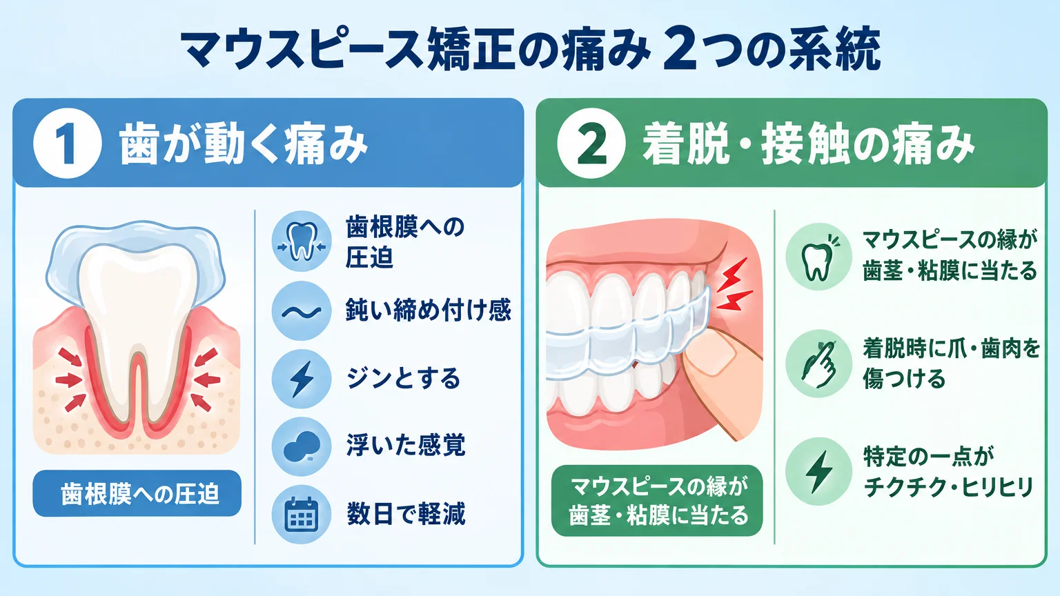 マウスピース矯正の痛みの2系統を比較するインフォグラフィック。左側「歯が動く痛み」＝歯根膜への圧迫、鈍い締め付け感・ジンとする・浮いた感覚、数日で軽減。右側「着脱・接触の痛み」＝マウスピースの縁が歯茎・粘膜に当たる／着脱時に爪・歯肉を傷つける、特定の一点がチクチク・ヒリヒリ。それぞれ歯のイラストと特徴を並記