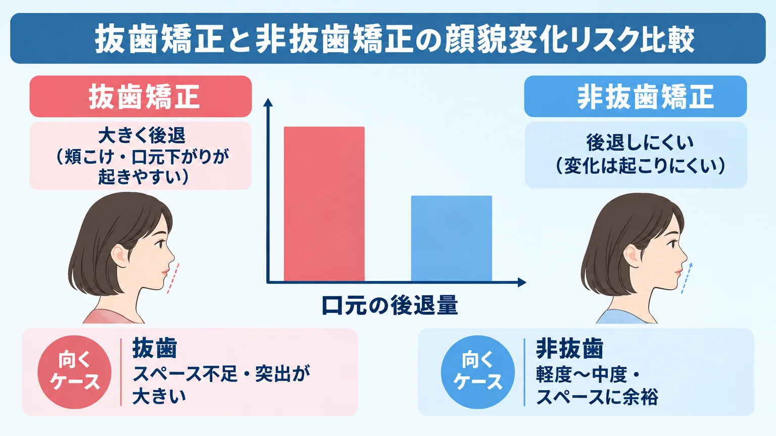 抜歯矯正と非抜歯矯正の顔貌変化リスク比較図。横軸に『口元の後退量』、2本の棒グラフで『抜歯矯正=大きく後退（頬こけ・口元下がりが起きやすい）』『非抜歯矯正=後退しにくい（変化は起こりにくい）』を示し、それぞれ向くケース『抜歯=スペース不足・突出が大きい』『非抜歯=軽度〜中度・スペースに余裕』を併記