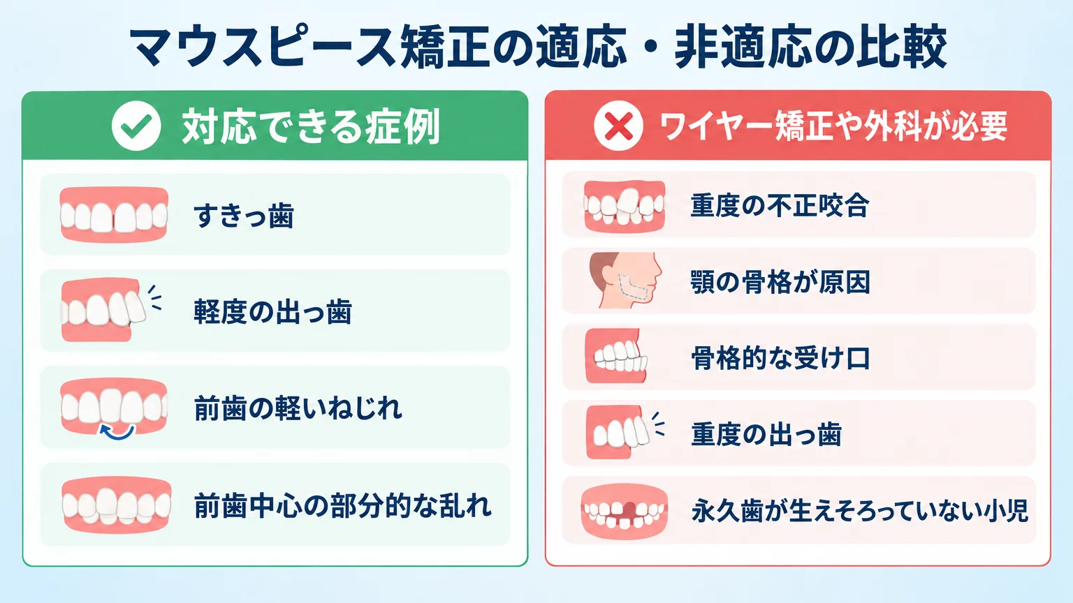 マウスピース矯正の適応・非適応を2列で比較するチャート。対応できる症例=すきっ歯・軽度の出っ歯・前歯の軽いねじれ・前歯中心の部分的な乱れ。ワイヤー矯正や外科が必要=重度の不正咬合・顎の骨格が原因・骨格的な受け口・重度の出っ歯・永久歯が生えそろっていない小児。日本語ラベル付き。