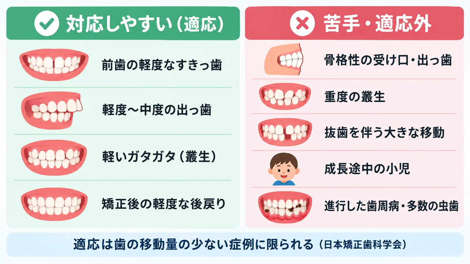 マウスピース矯正の適応・適応外を2列で示す比較イラスト。左列『対応しやすい（適応）』=前歯の軽度なすきっ歯、軽度〜中度の出っ歯、軽いガタガタ（叢生）、矯正後の軽度な後戻り。右列『苦手・適応外』=骨格性の受け口・出っ歯、重度の叢生、抜歯を伴う大きな移動、成長途中の小児、進行した歯周病・多数の虫歯。下部に『適応は歯の移動量の少ない症例に限られる（日本矯正歯科学会）』と注記