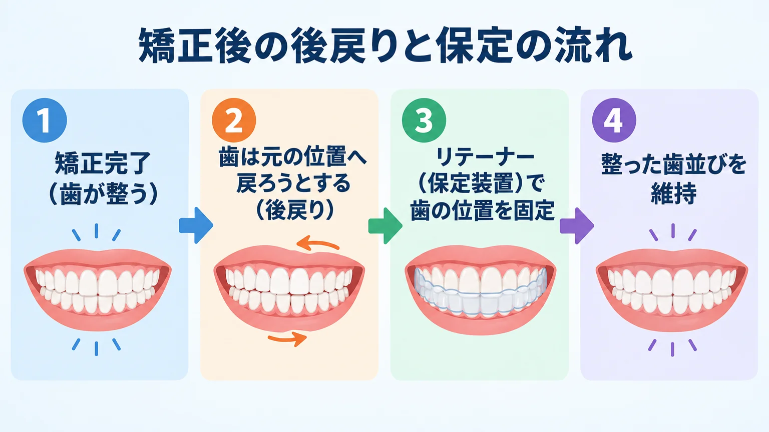 矯正後の後戻りと保定の流れを示すフロー図。「矯正完了（歯が整う）」→「歯は元の位置へ戻ろうとする（後戻り）」→「リテーナー（保定装置）で歯の位置を固定」→「整った歯並びを維持」の4ステップを矢印でつなぐイラスト