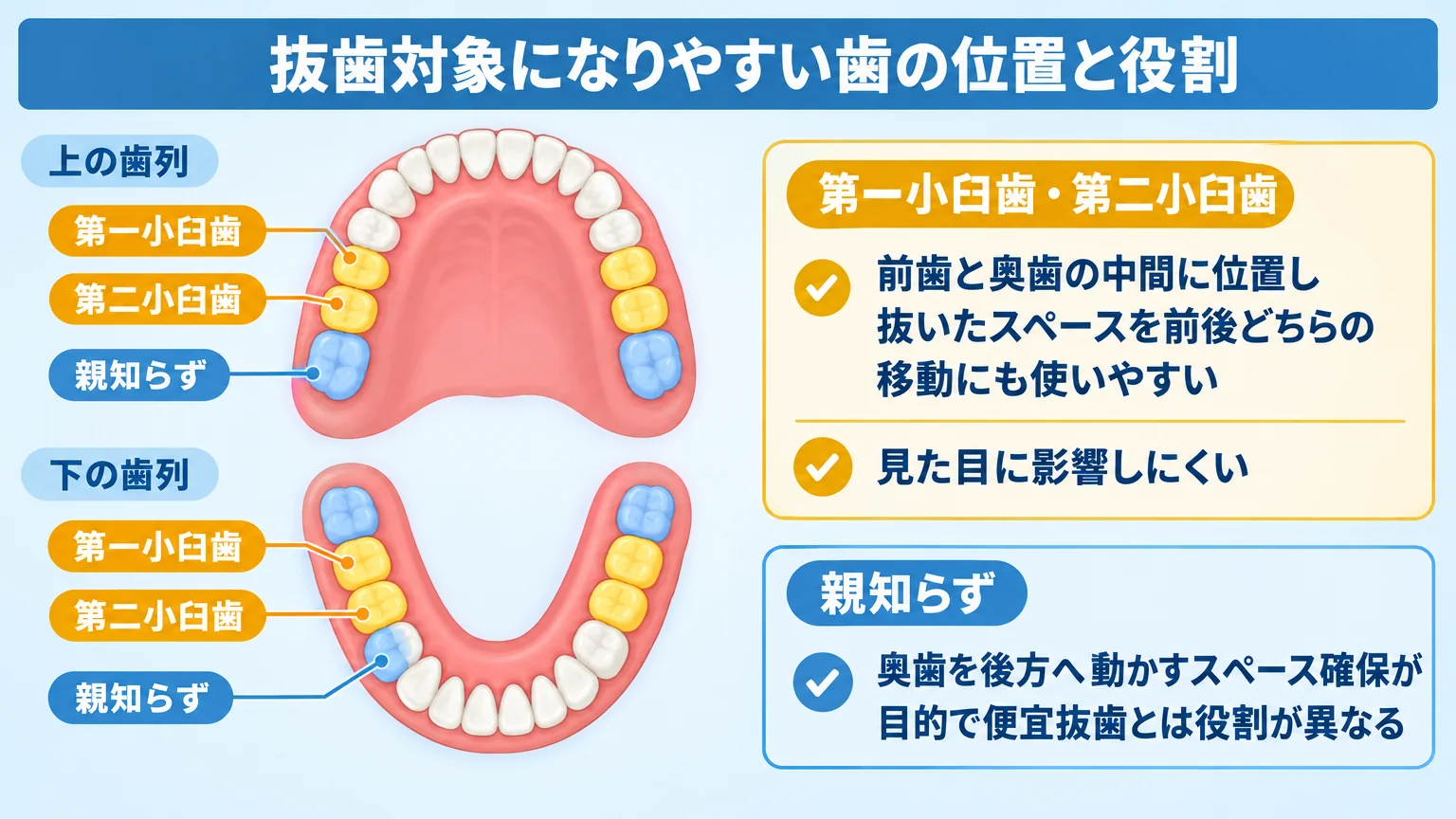 上下の歯列イラストで抜歯対象になりやすい歯を示す図。犬歯の後ろにある『第一小臼歯』と『第二小臼歯』をハイライトし、『前歯と奥歯の中間に位置し、抜いたスペースを前後どちらの移動にも使いやすい』『見た目に影響しにくい』と注記。あわせて『親知らず』を別色で示し『奥歯を後方へ動かすスペース確保が目的で便宜抜歯とは役割が異なる』と対比する