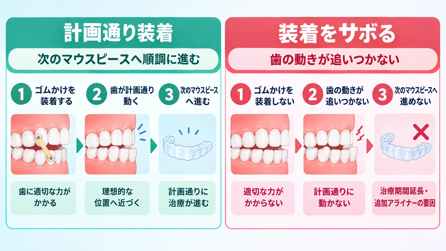 ゴムかけを装着した場合と装着をサボった場合の治療進行を比較するインフォグラフィック。左『計画通り装着:次のマウスピースへ順調に進む』右『装着をサボる:歯の動きが追いつかない→次のマウスピースへ進めない→治療期間延長・追加アライナーの要因』の2列構成