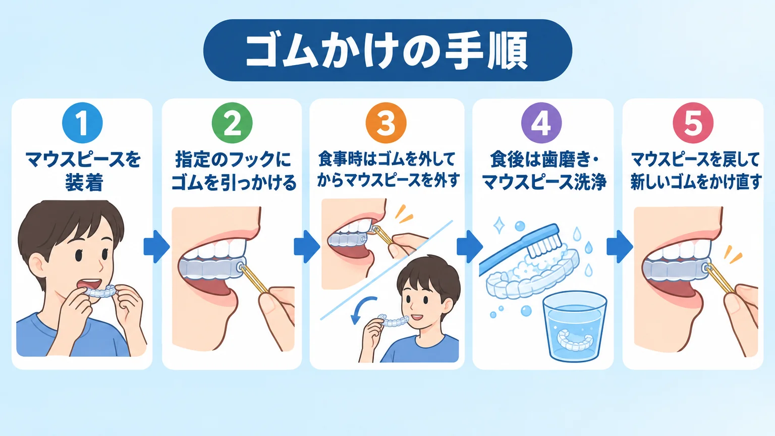 ゴムかけの一連の手順を示すフロー図。①マウスピースを装着 ②指定のフックにゴムを引っかける ③食事時はゴムを外してからマウスピースを外す ④食後は歯磨き・マウスピース洗浄 ⑤マウスピースを戻して新しいゴムをかけ直す、の5ステップを矢印でつなぐ