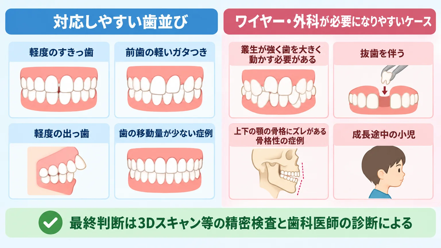 マウスピース矯正の適応傾向を2分割で示すイラスト図。左側「対応しやすい歯並び」に軽度のすきっ歯・前歯の軽いガタつき・軽度の出っ歯・歯の移動量が少ない症例。右側「ワイヤー・外科が必要になりやすいケース」に叢生が強く歯を大きく動かす必要がある・抜歯を伴う・上下の顎の骨格にズレがある骨格性の症例・成長途中の小児。下部に『最終判断は3Dスキャン等の精密検査と歯科医師の診断による』の注記
