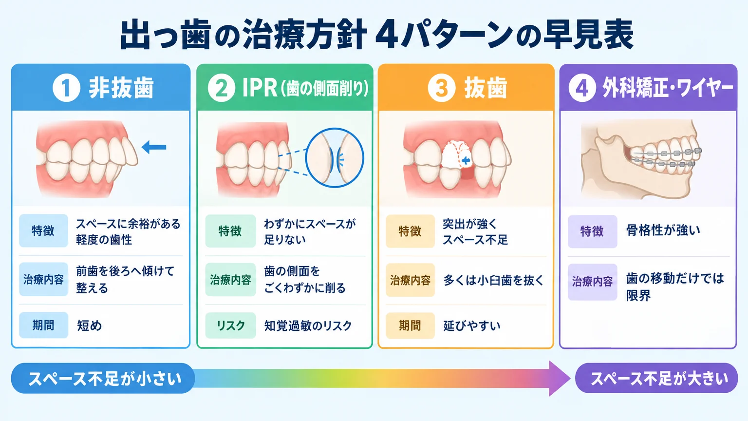 出っ歯の治療方針4パターンの早見表チャート。『①非抜歯:スペースに余裕がある軽度の歯性、前歯を後ろへ傾けて整える、期間短め』『②IPR(歯の側面削り):わずかにスペースが足りない、歯の側面をごくわずかに削る、知覚過敏のリスク』『③抜歯:突出が強くスペース不足、多くは小臼歯を抜く、期間は延びやすい』『④外科矯正・ワイヤー:骨格性が強い、歯の移動だけでは限界』。スペース不足の度合いが小→大へ並ぶ